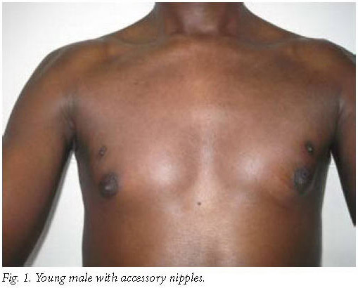 Academic Onefile Document Benign Breast Conditions In Young
