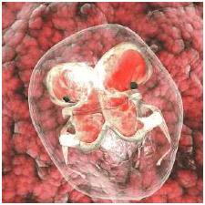 Illustration of conjoined embryos. Conjoined twins are a rare subtype of identical twins that result from incomplete splitting after the twelfth day of embryonic development.
