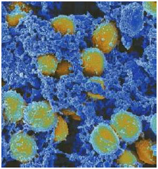 Digitally-colorized scanning electron micrograph of Staphylococcus aureus bacteria.