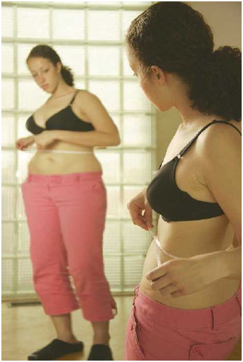 Young woman with body dysmorphic disorder, a condition where she sees herself as larger than she really is.