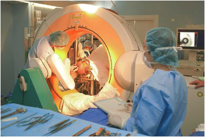 Surgical treatment of Parkinson's disease by deep brain stimulation, The combination of surgical robot Neuromate and scanner.