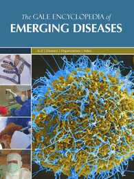 The Gale Encyclopedia of Emerging Diseases, ed. , v. 