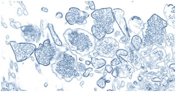 Transmission electron micrograph (TEM) depicts a number of Nipah virus virions that had been isolated from a patient's cerebrospinal fluid (CSF) specimen.