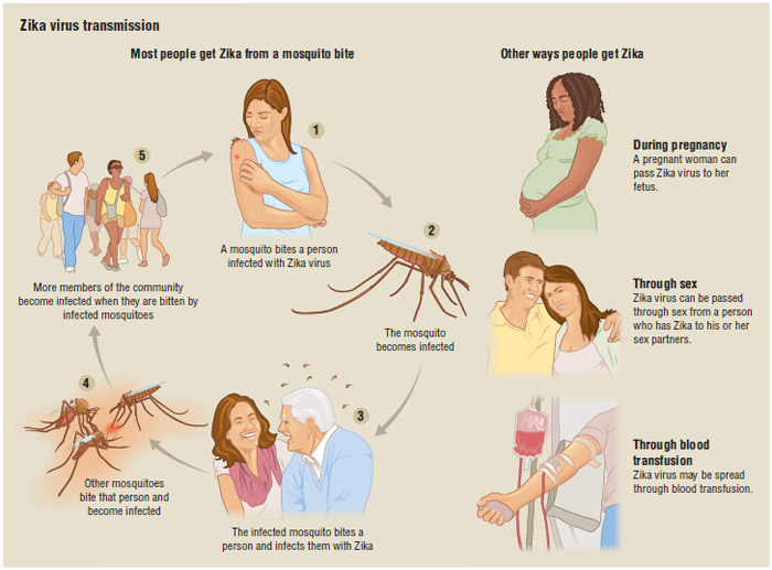 Zika Virus Disease, Definition, Description, Demographics, Causes and