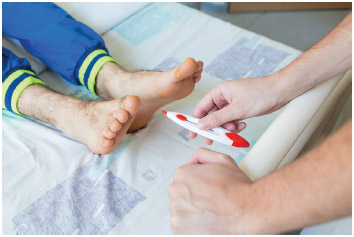 Monofilament test being carried out on a foot to test for nerve damage in a diabetic patient.