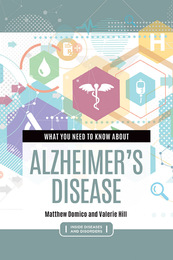 What You Need to Know about Alzheimer's Disease, ed. , v. 