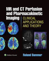 MR and CT Perfusion and Pharmacokinetic Imaging, ed. , v. 