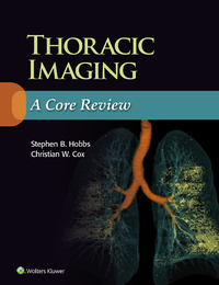 Thoracic Imaging, ed. , v. 