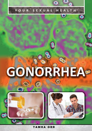 Gonorrhea, ed. , v. 