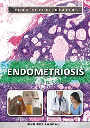 Endometriosis, ed. , v. 