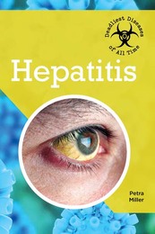 Hepatitis, ed. , v. 