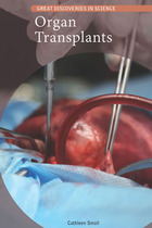 Organ Transplants, ed. , v. 
