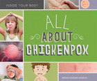 All About Chickenpox, ed. , v.  Cover