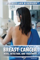 Breast Cancer, ed. , v. 