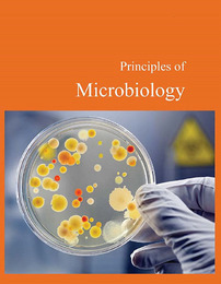 Principles of Microbiology, ed. , v. 