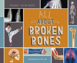 All About Broken Bones, ed. , v. 