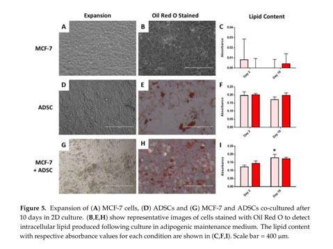 Bioprinted Three Dimensional Cell Laden Hydrogels To Evaluate Adipocyte Breast Cancer Cell Interactions Document Gale Academic Onefile