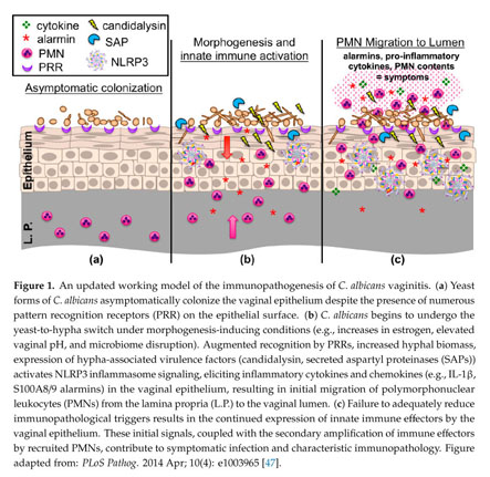 Vulvovaginal Candidiasis: A Current Understanding and Burning