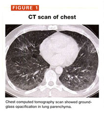 Gale Academic Onefile Document Hot Tub Lung Is It On Your List Of Respiratory Ailments