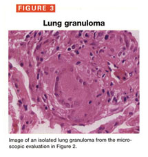 Gale Academic Onefile Document Hot Tub Lung Is It On Your List Of Respiratory Ailments