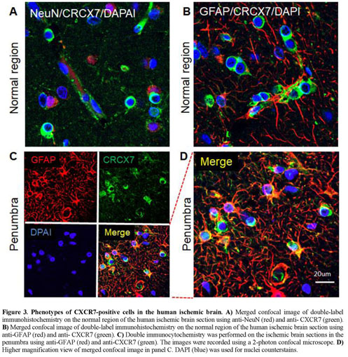 Spi Cam In Wc.Gale Academic Onefile Document Sdf 1 Cxcr7 Chemokine Signaling Is Induced In The Peri Infarct Regions In Patients With Ischemic Stroke