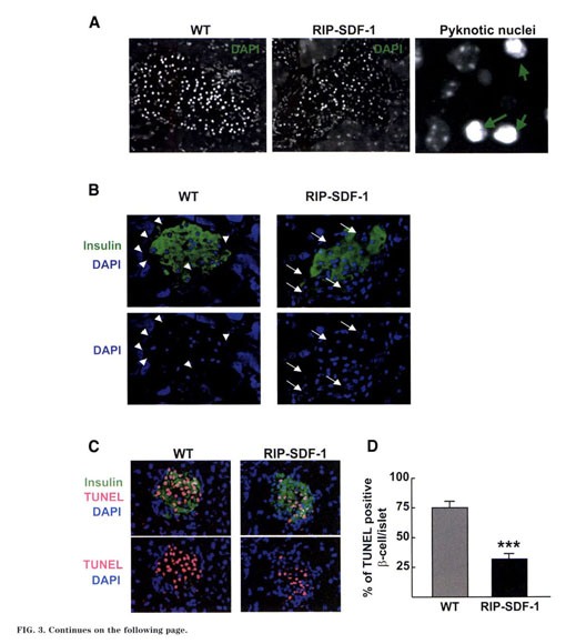 gale academic onefile document stromal cell derived factor 1 sdf 1 cxcl12 attenuates diabetes in mice and promotes pancreatic beta cell survival by activation of the prosurvival kinase akt stromal cell derived factor