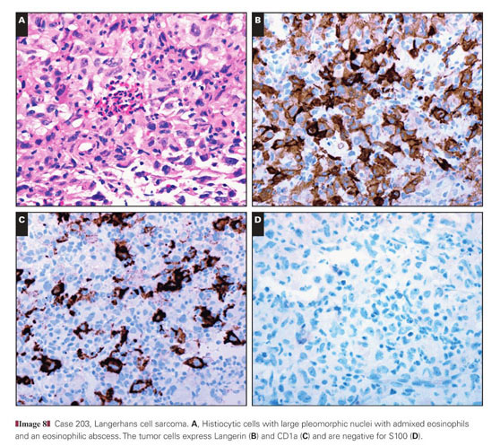 Axillary manifestations of dermatologic diseases: a focused review -  Document - Gale Academic OneFile