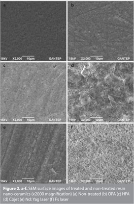 Bond Strength of Metal and Ceramic Brackets on Resin Nanoceramic Material  With Different Surface Treatments. - Document - Gale OneFile: Health and  Medicine