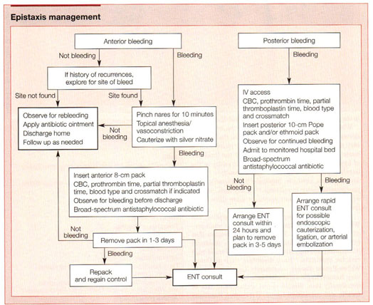 Current Approaches To The Management Of Epistaxis Treatment Of Nosebleed Varies According To