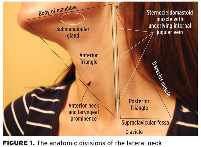 hpv neck mass