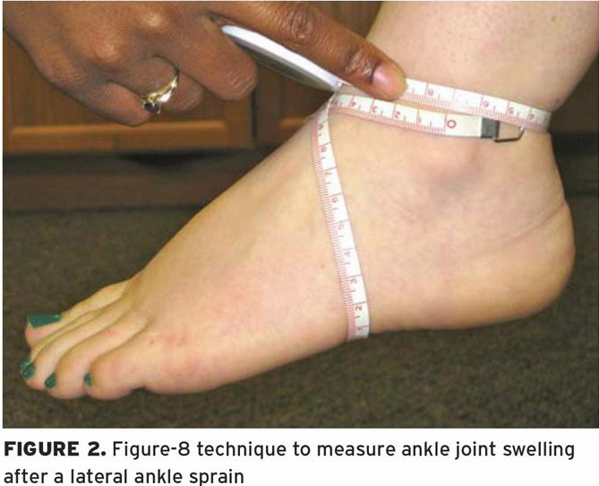 Figure of 8 Method  Measuring Ankle Swelling/Edema 