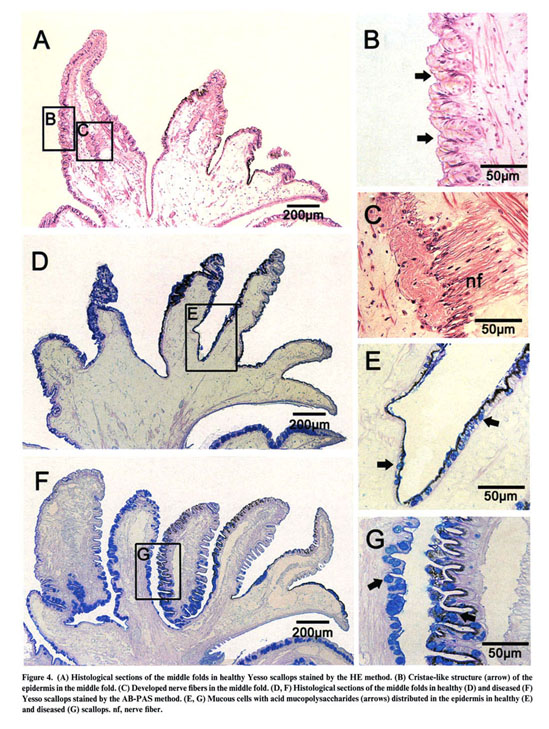 HISTOLOGICAL CHANGES IN THE MANTLE TISSUE OF THE YESSO SCALLOP