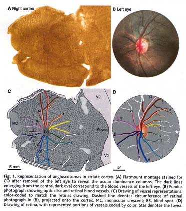 Shadows Cast by Retinal Blood Vessels Mapped in Primary Visual Cortex