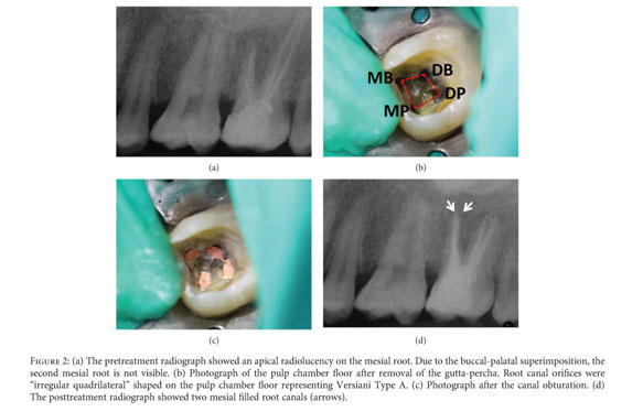 Gale Onefile Health And Medicine Document Endodontic