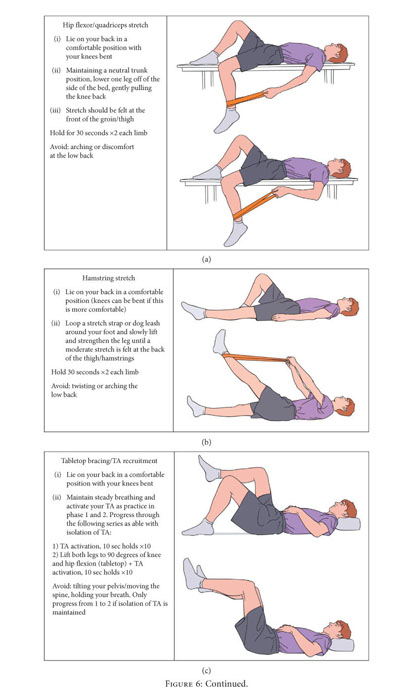 spondylolisthesis physical therapy exercises