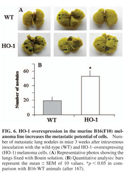 The different functions and clinical significances of caveolin-1 in human  adenocarcinoma and squamous cell carcinoma - Document - Gale OneFile:  Health and Medicine