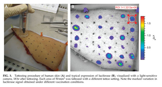 DNA Vaccines and Intradermal Vaccination by DNA Tattooing