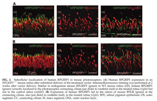 Replacement gene therapy with a human RPGRIP1 sequence slows