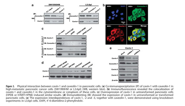 The different functions and clinical significances of caveolin-1 in human  adenocarcinoma and squamous cell carcinoma - Document - Gale OneFile:  Health and Medicine