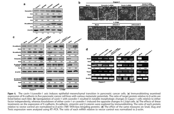 The different functions and clinical significances of caveolin-1 in human  adenocarcinoma and squamous cell carcinoma - Document - Gale OneFile:  Health and Medicine