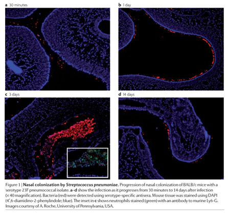 Nose picking is major source of S. pneumoniae colonization