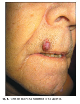 Axillary manifestations of dermatologic diseases: a focused review -  Document - Gale Academic OneFile