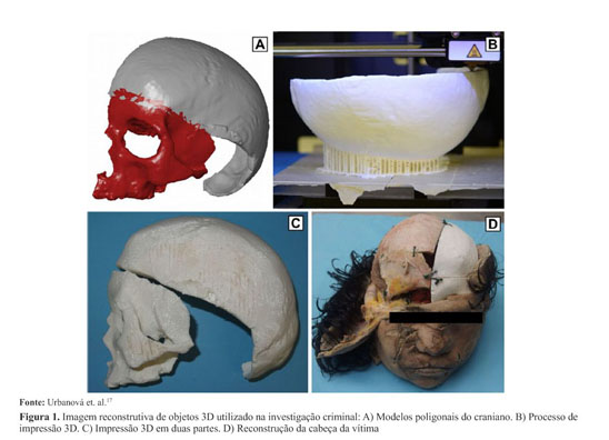 USP cria projeto que simula cirurgia craniana com impressão 3D e