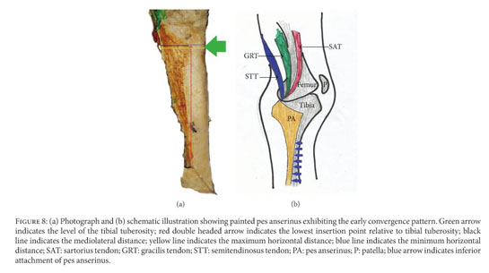 Pes anserinus structural framework and constituting tendons are grossly