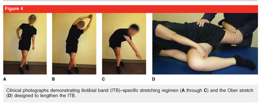 Renne's Test  Iliotibial Band Friction Syndrome ITBS 