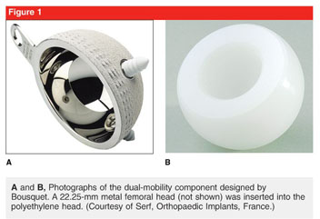 The use of dual-mobility components in total hip arthroplasty - Document -  Gale Academic OneFile