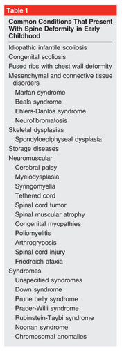 Rubinstein-Taybi syndrome with scoliosis treated with single-stage