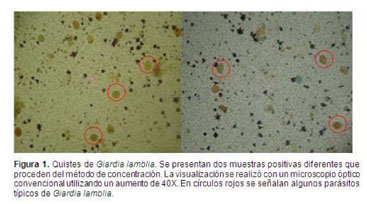 quistes de giardia en heces