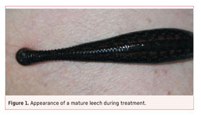 Maintenance / Products - Biopharm Leeches