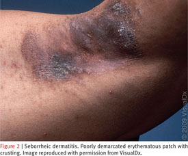 Axillary manifestations of dermatologic diseases: a focused review